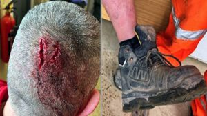 Head injury from loose boots
