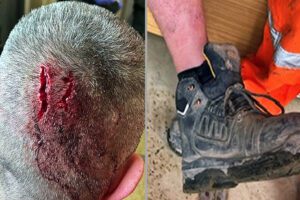 Head injury from loose boots